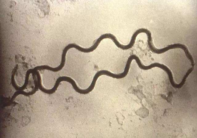 梅毒竟被称为“爱神病”:法国贵族以得病为豪，*队军**被美女诱惑崩溃