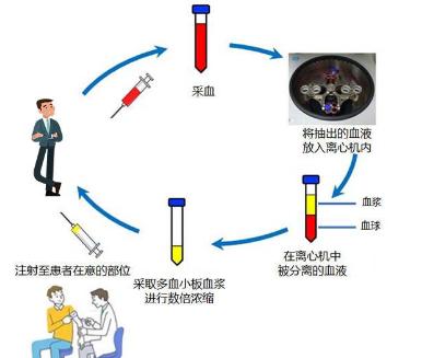 膝关节骨性关节炎锻炼方法示意图,膝盖疼痛当心膝关节骨性关节炎