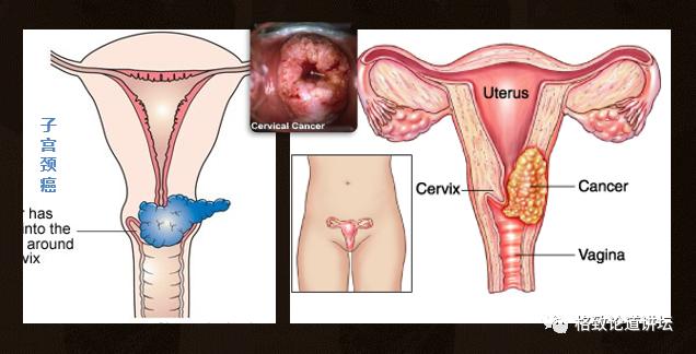 身为女人的我们如何保护好自己,作为人类我们如何保护地球