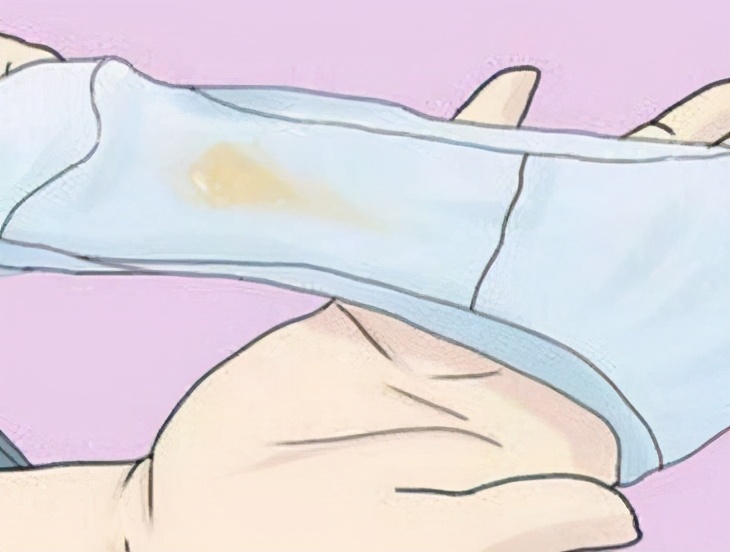 妇科瘙痒白带排不出怎么回事,最近白带多有臭味怎么办