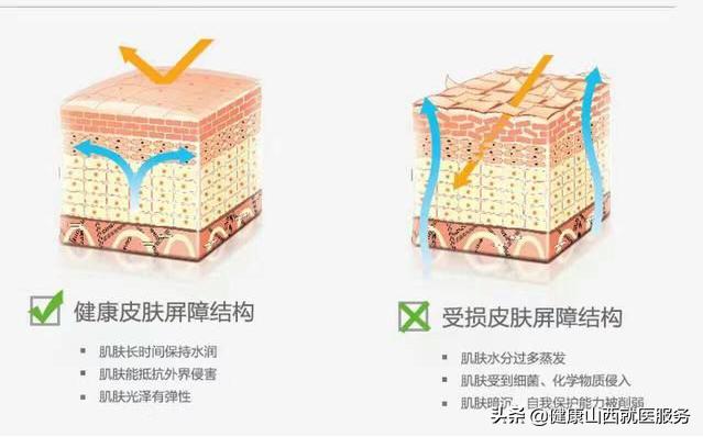 肌肤干燥敏感长痘怎么办,皮肤敏感泛红干燥怎么修复