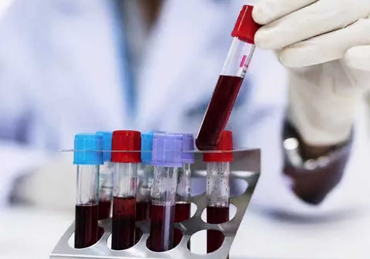 男子脚扭伤查出肾衰竭,为何年轻人易得肾病?这4点可修复肾功能