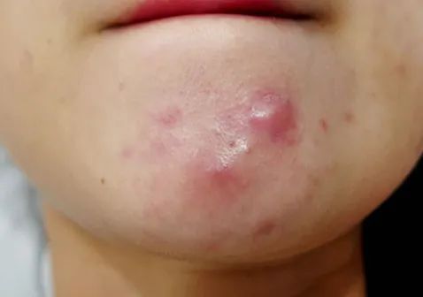 自己种的芦荟做面膜有什么功效,自己用芦荟做面膜