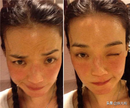 换季洗完脸发红一块一块的,换季脸又油又干