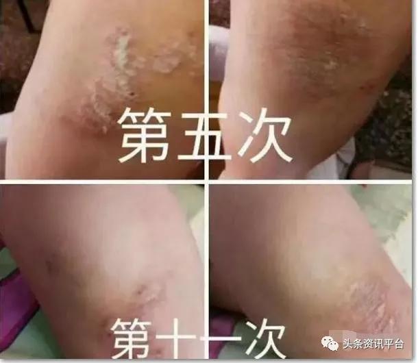 中氢平通仪真的能排毒吗,中科氢量平通仪真的有效果吗