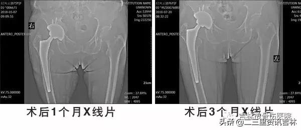 从医30余年，他治疗数以万计骨伤骨病患者