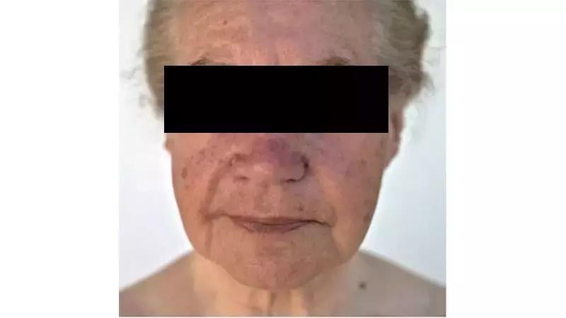 皮肤科医生告诉你如何护肤,皮肤科医生告诉你如何抗老