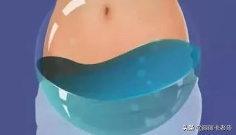 腹部恶性肿瘤引起盆腔积液腹胀,肿瘤盆腔积液和腹部积液