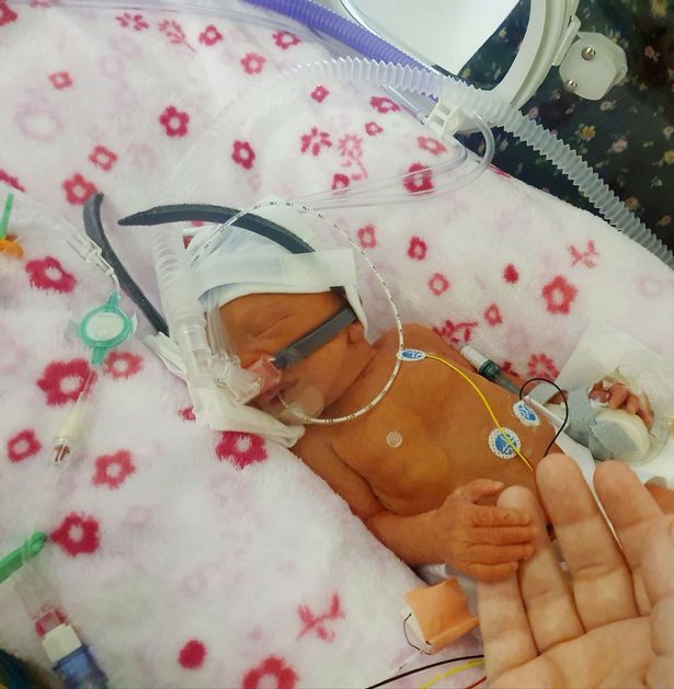 怀孕的孕妇羊水破了要生了,英国孕妇羊水破了