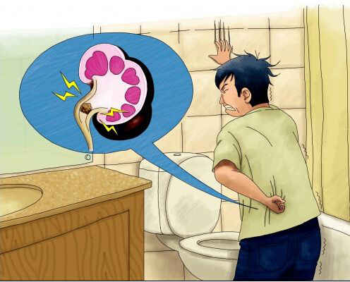 传言说我们体内的“小石头”是吃出来的，到底真假？