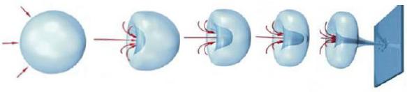 冲击疗法详细介绍,冲击疗法属于什么疗法