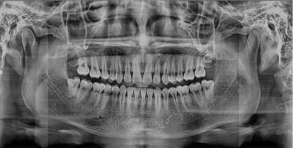 治疗牙病有哪些方法,治疗牙病一般医院都能治疗吗