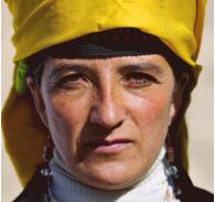 连迪丽热巴都躲不过的颜值毒药？现在预防还来得及