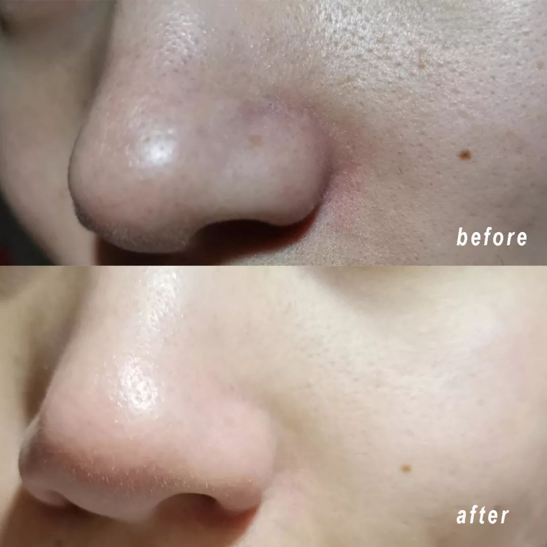 清洁面膜测评真实,清洁面膜测评打假