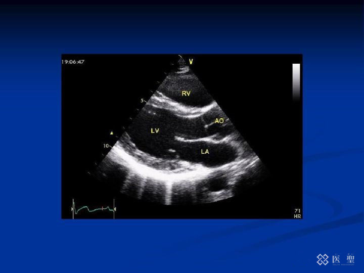 iseihealth:40岁以上的妇女至少应做的16项检查清单