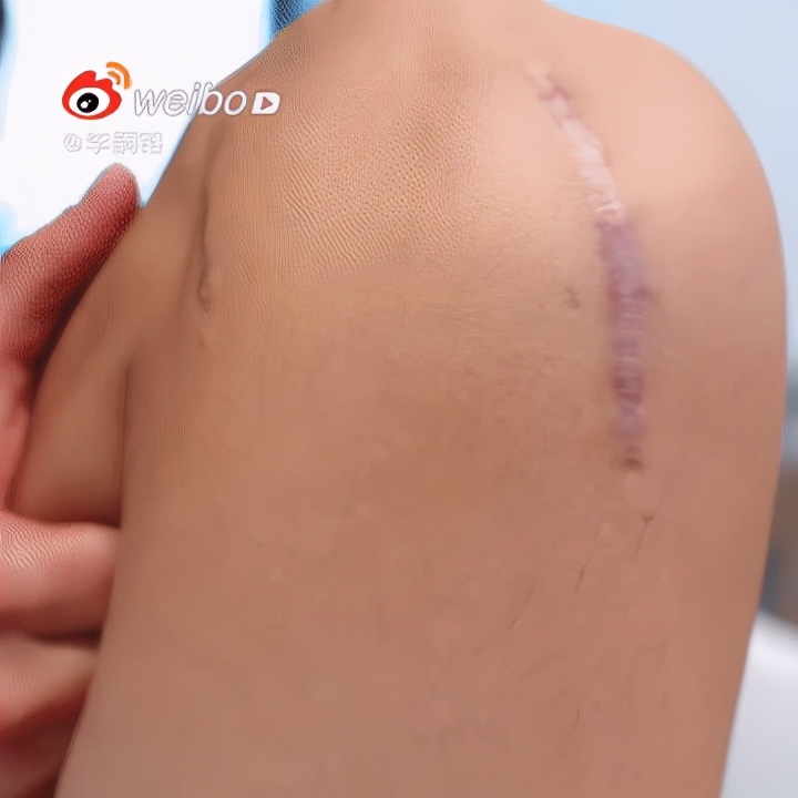 足球界陈冠希爆红,足坛中的陈冠希