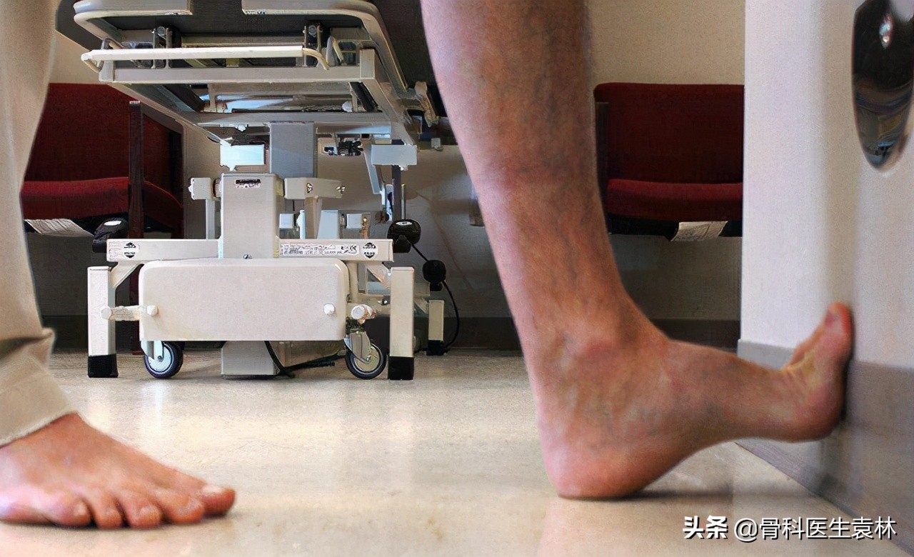 半月板损伤撕裂二度可以手术吗,半月板损伤了需要怎么做手术修复