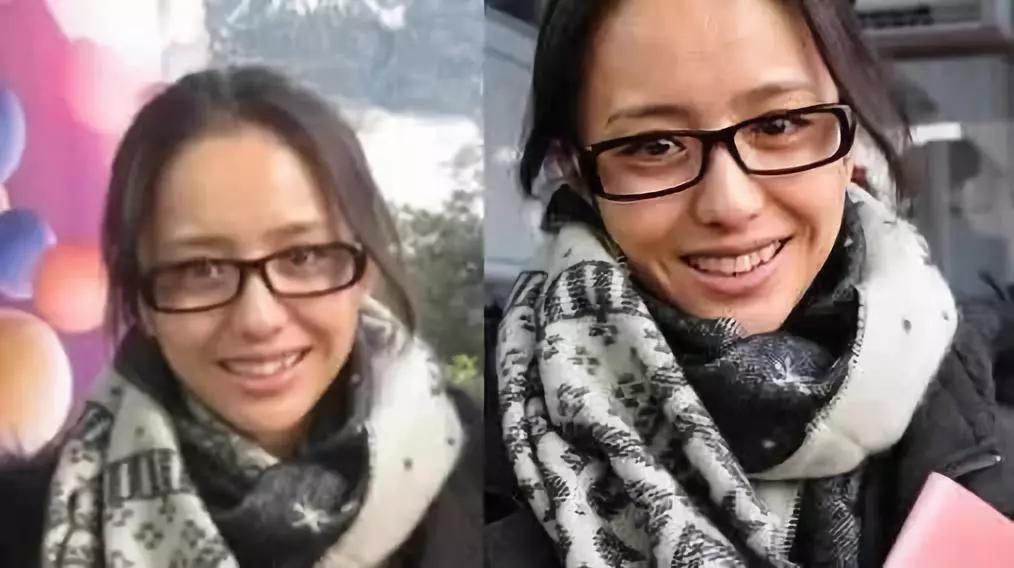 30多岁的她变瘦皮肤松弛,37岁女人瘦下来后变老了