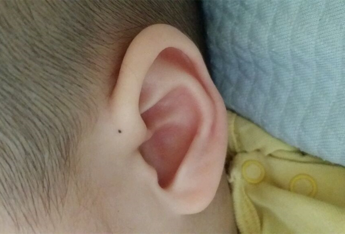 孩子耳朵里进虫子处理视频,孩子耳朵里进虫子