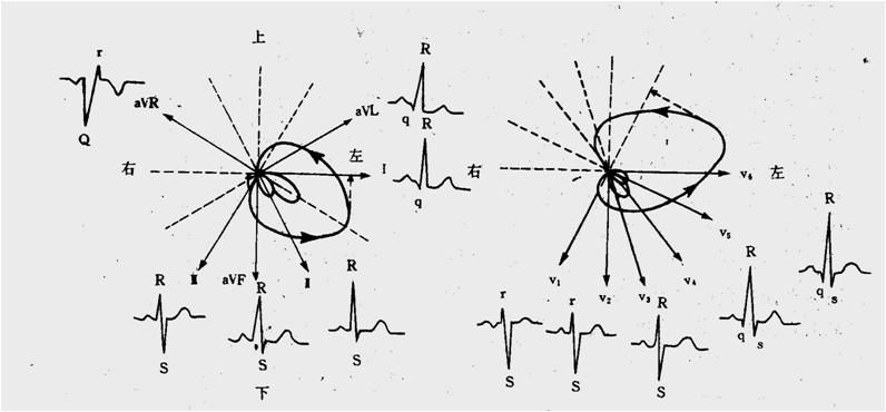 急性心肌梗死的做法,内科主治心肌梗死视频