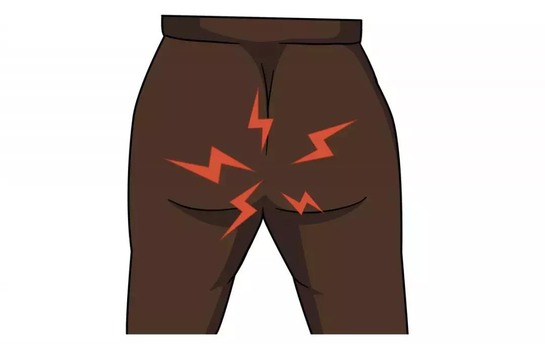 菊花痛没在意，最后整个屁股被掏空！肛门问题千万别不当回事