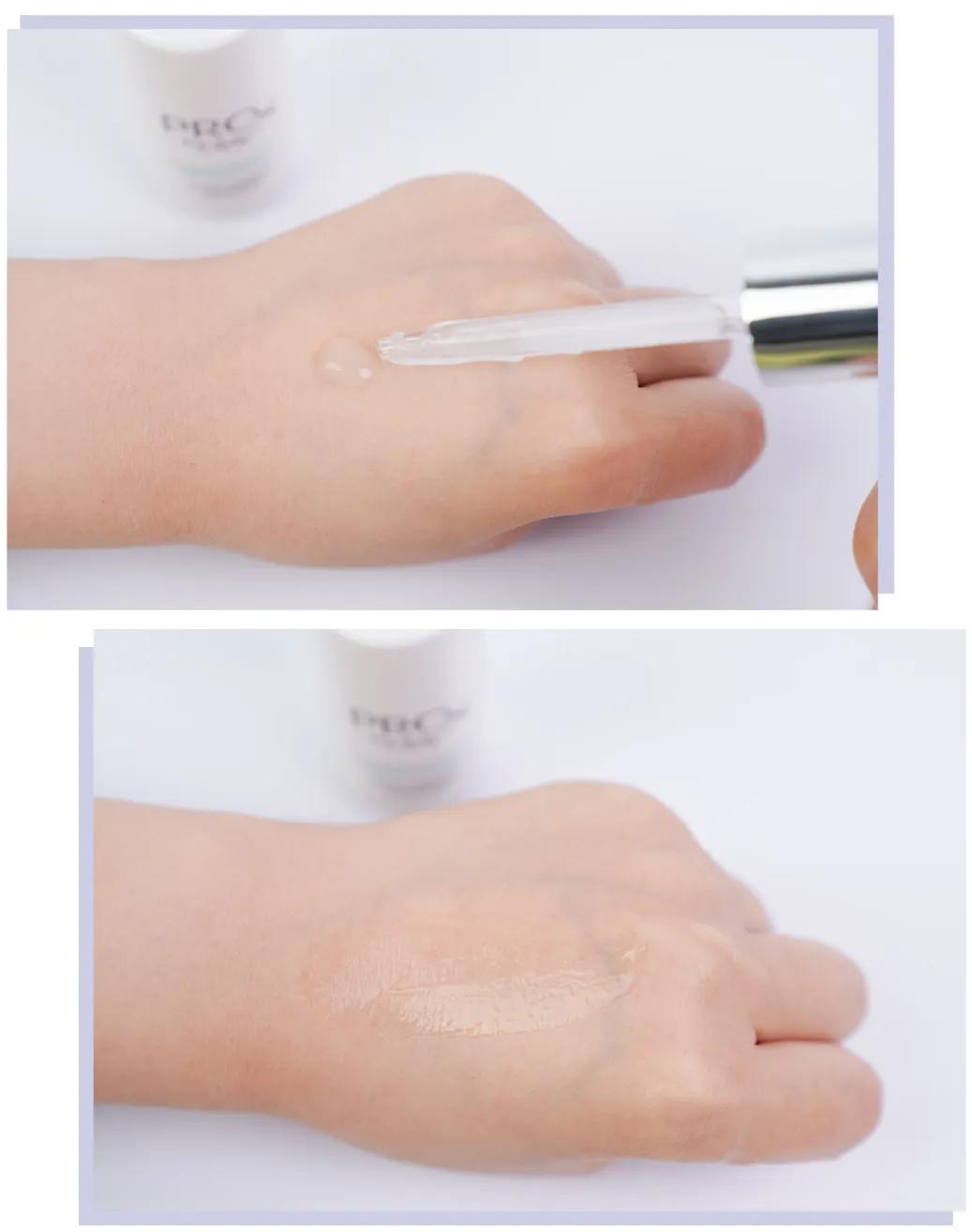 脸上的斑可以通过医美去掉吗,脸上长斑了能用激光去除吗