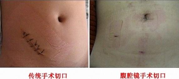 鍚村溅绁栫殑鐩茶偁婧冪儌鍘熷洜,鍚村溅绁栫湡鐨勬湁鐩茶偁鐐庡悧