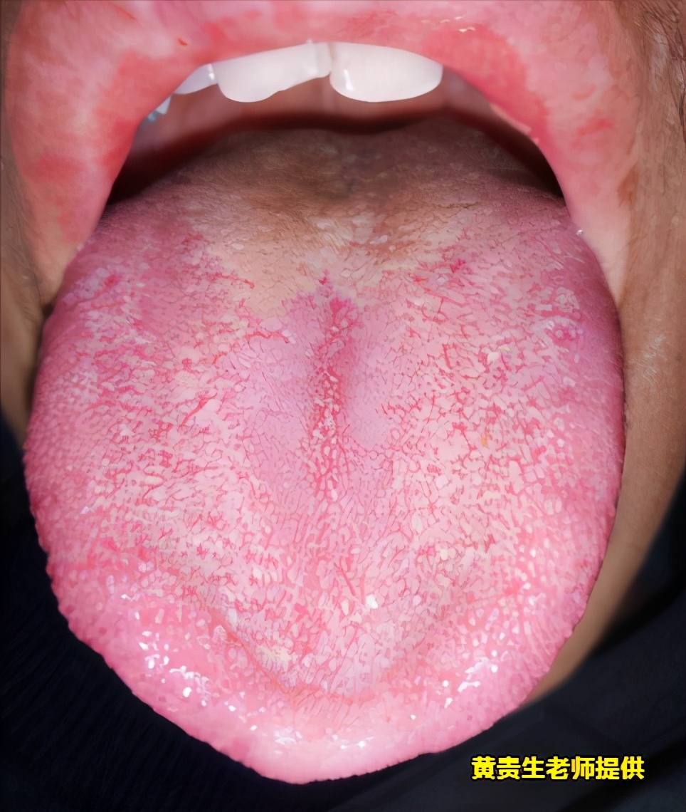 和癌症一起做斗争,癌症防治大赛