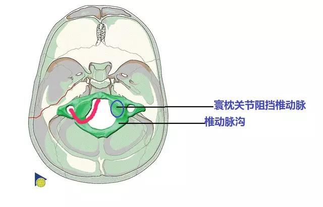 颈部血管椎动脉分段解剖图,椎动脉横断面图