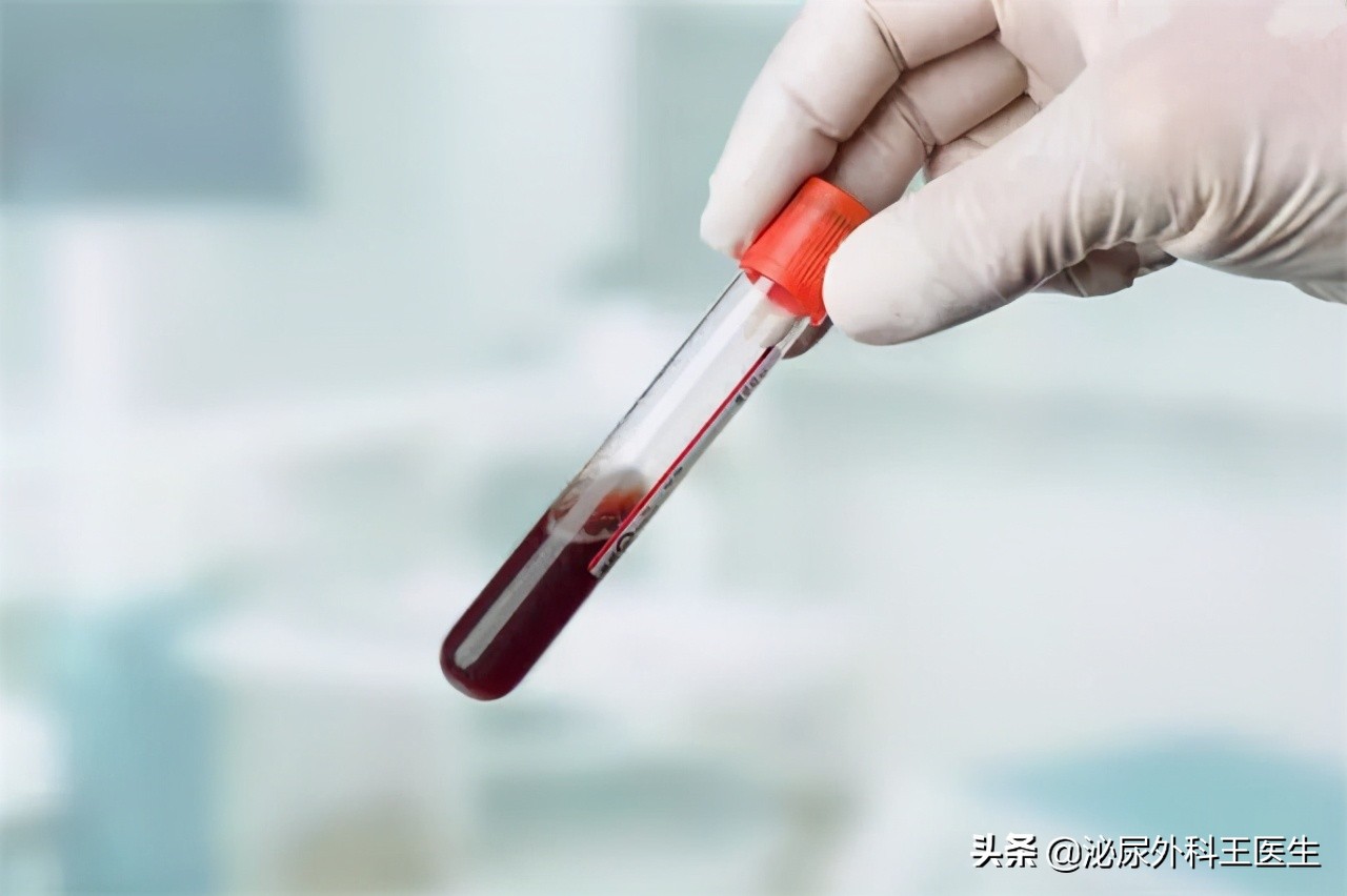 性病“梅毒”是如何横扫世界？