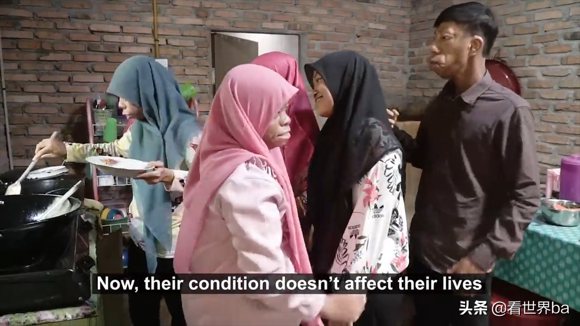 印尼家族怪脸,印尼怪病