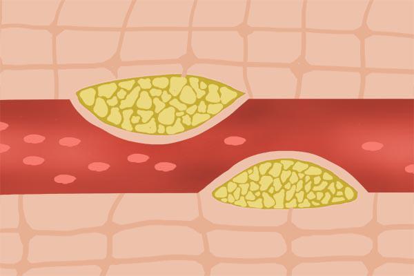 女人过了50岁，总是感觉到疲劳、乏力，是怎么回事？如何缓解？