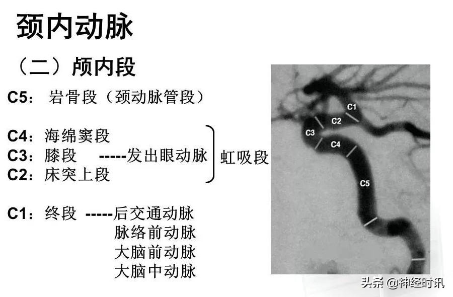 脑动脉解剖学讲解,基底节区脑血管解剖
