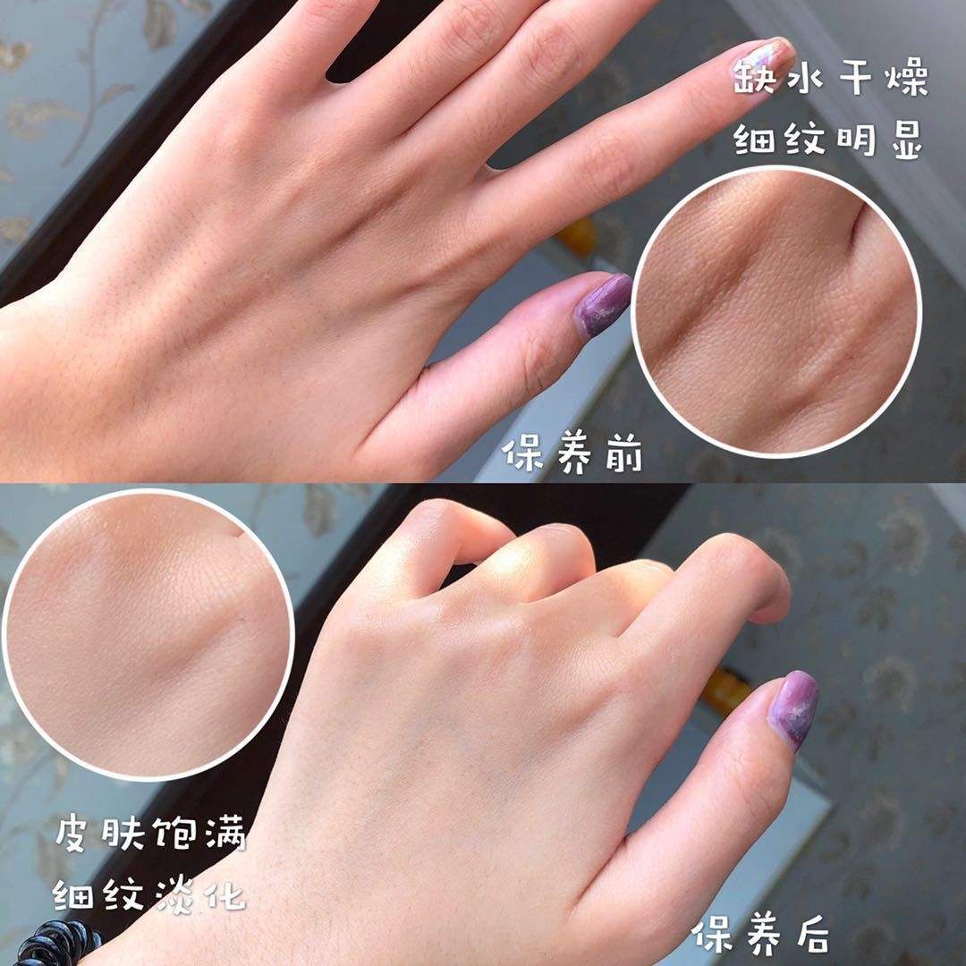 王凯手被投保3600万?林更新堵车时不忘涂手霜,我承认自己不精致