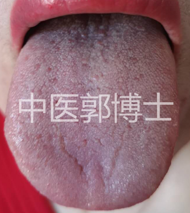 45岁闭经经方咋治,月经不调绝经用啥中药