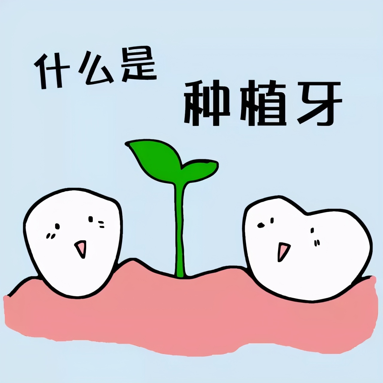 种植牙是不是要坏牙全拔,1颗牙坏了做牙套好还是种植牙好