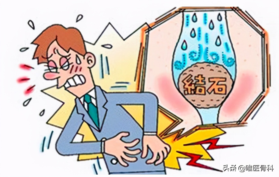 有肾结石的孩子可以喝补钙的吗,骨质疏松肾结石的正确补钙方法