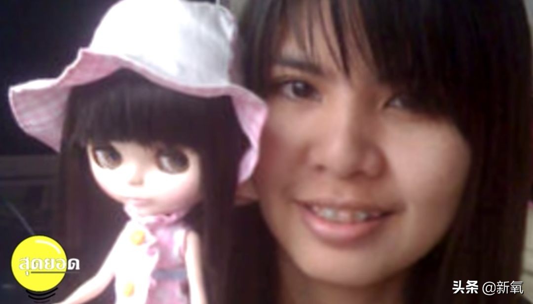 18岁土肥圆豪掷800万全身整形，鼻子6次大整假体穿出，效果却超美