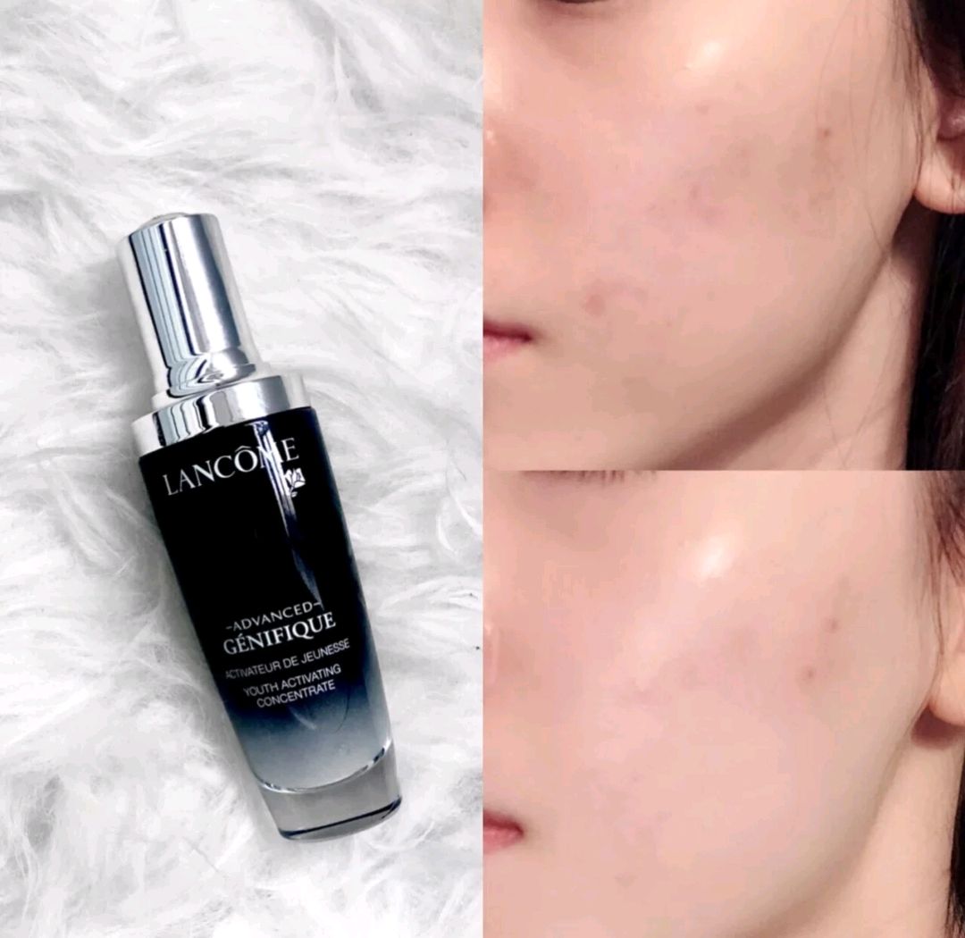 夏季清爽保湿型精华液：黛珂小紫瓶干爽细腻，韩束红胶囊便宜好用