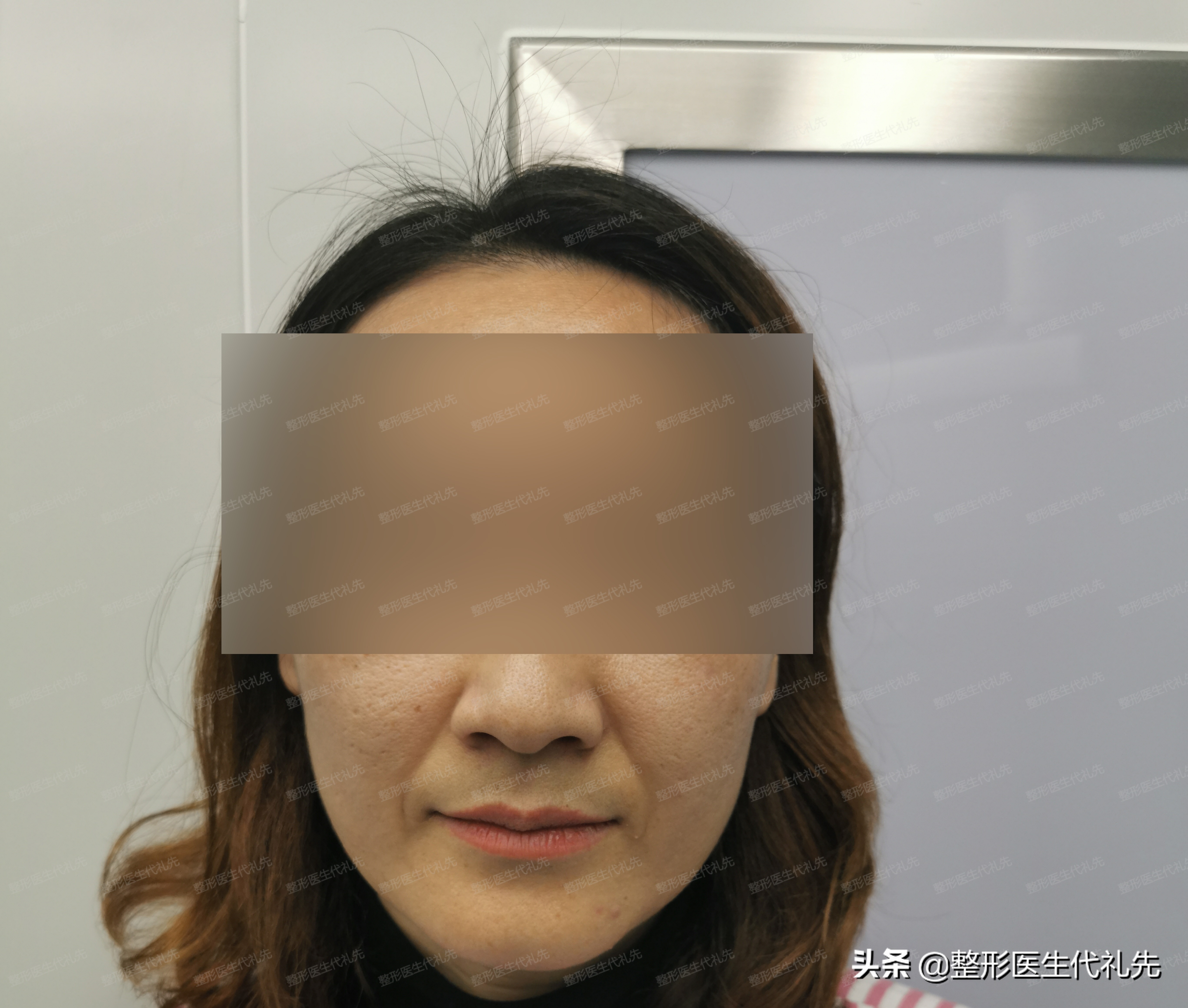 法令纹怎么改善三个方法学起来,有没有特别好的淡化法令纹的方法