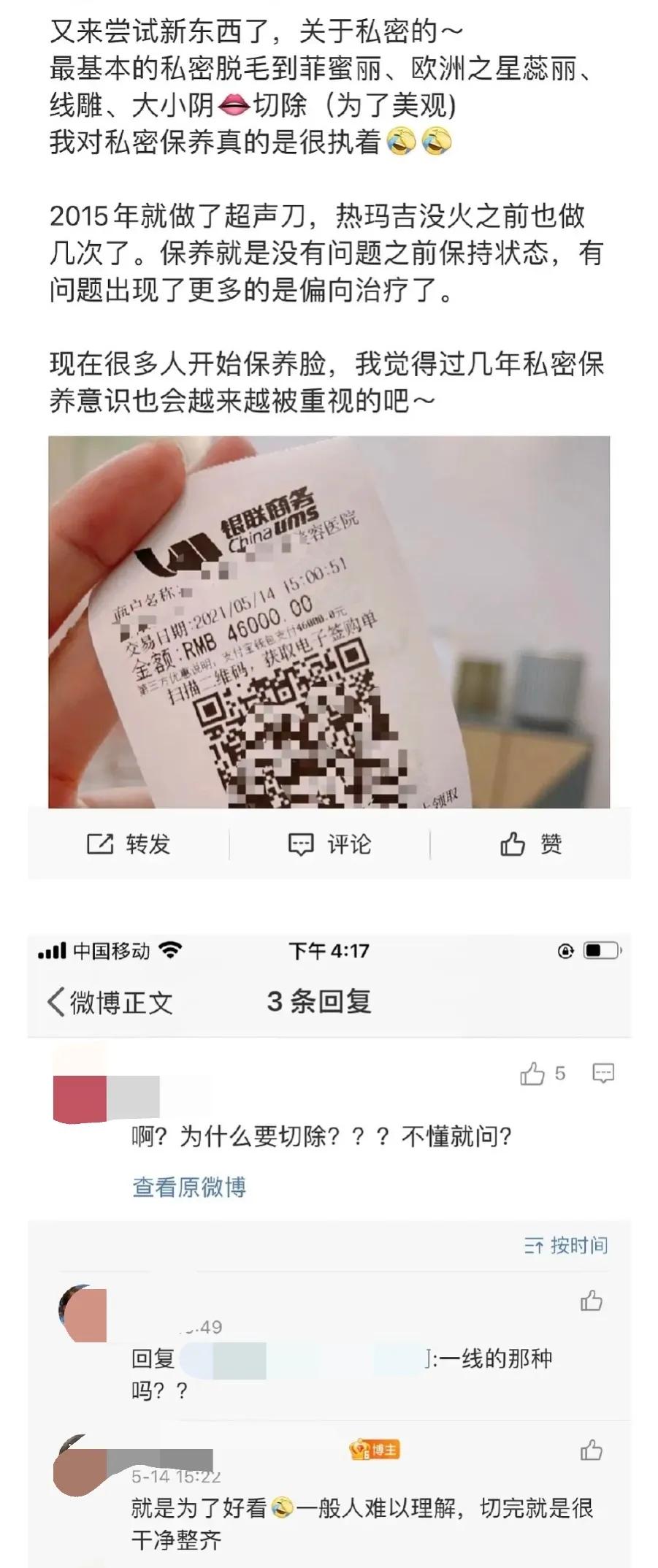 整形小腿肌肉切除,腿部整形手术好吗