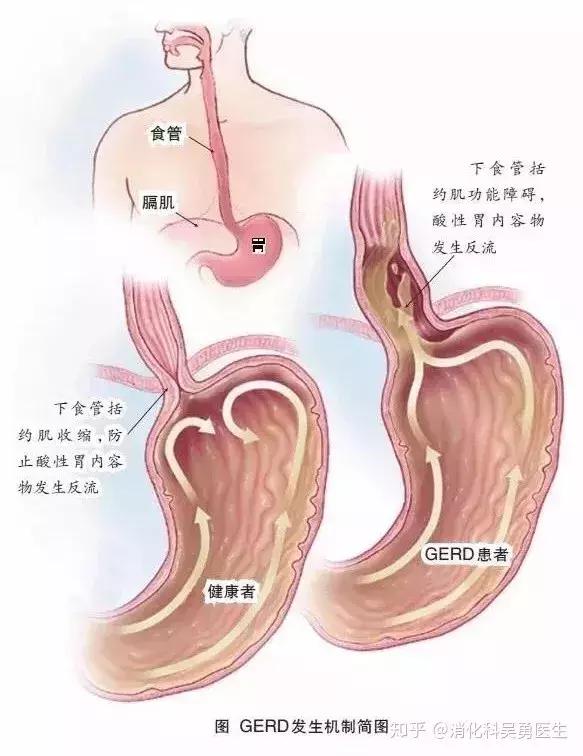 束腰，有人diss有人爱，到底要不要买？可能是全网第二全的一篇