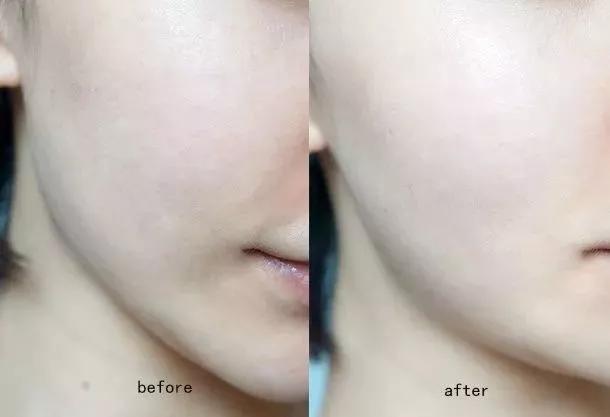 火遍日本的国产面膜,敷尔佳清痘面膜真实测评