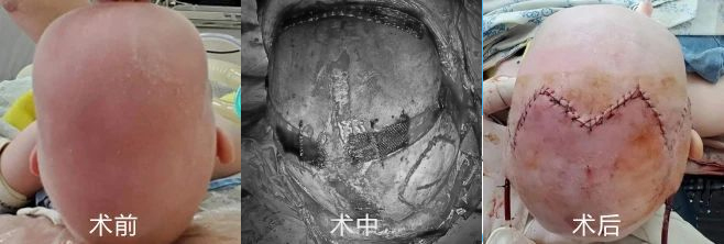 孩子的头偏小怎么办,孩子扁头偏头