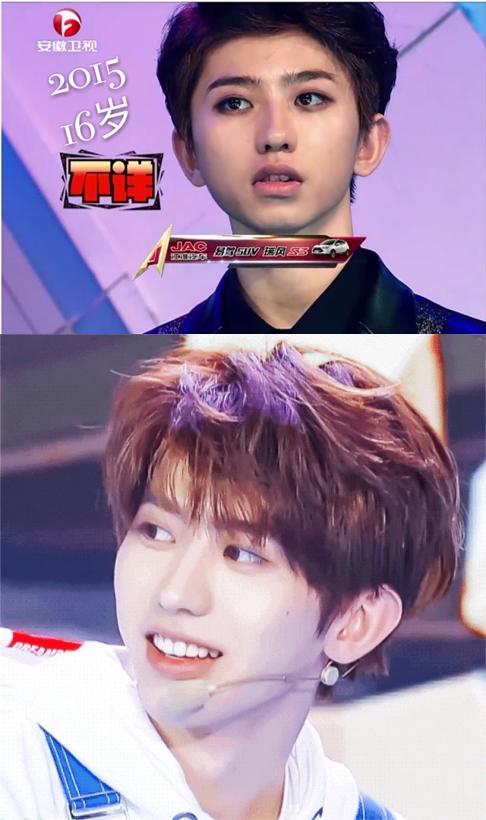 蔡徐坤整牙前后对比图片,蔡徐坤整牙前图片