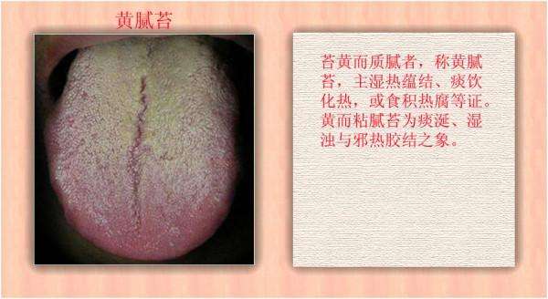 怎样准确判断胃火,辨证论治的关键