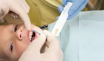 蛀牙治疗科普,蛀牙安全有效的方法