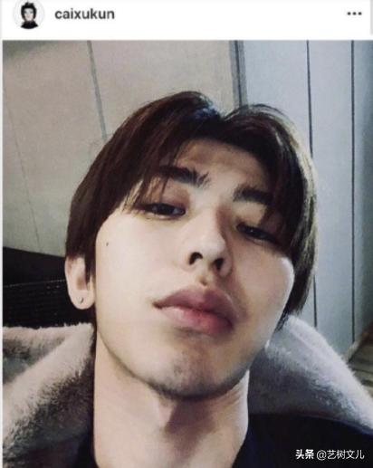蔡徐坤受伤一点不慌展现硬汉风采,蔡徐坤再度回应p图