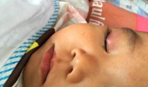 儿子误把502滴眼睛,宝妈反应迅速医生夸奖,但家长不能跟一辈子