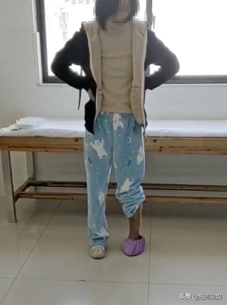 交通事故小腿胫骨骨折做手术,常德市第一中医医院骨伤科